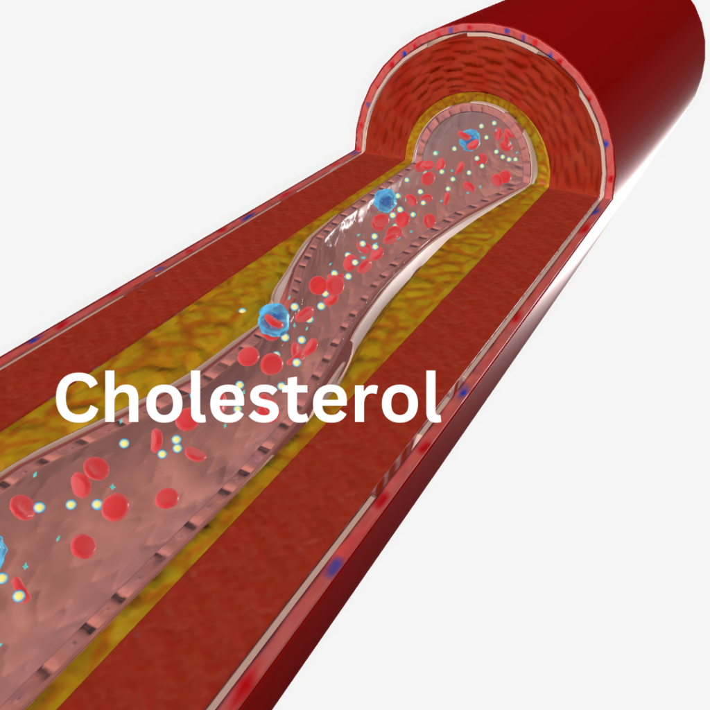 Cholesterol 1