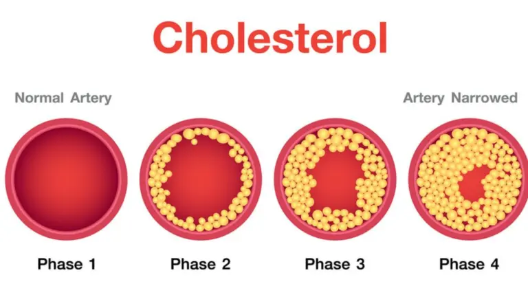 Cholesterol